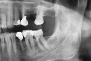 Radiografie digitală panoramic secțional