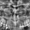Radiografie digitală panoramică sinusuri