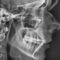 Radiografie- teleradiografie digitală de profil